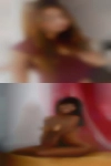Mole forehead amateur swinger