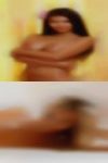 Mole forehead amateur swinger