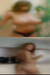 Mole forehead amateur swinger